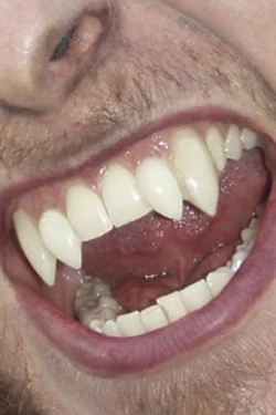 Zuby vlkodlak deluxe